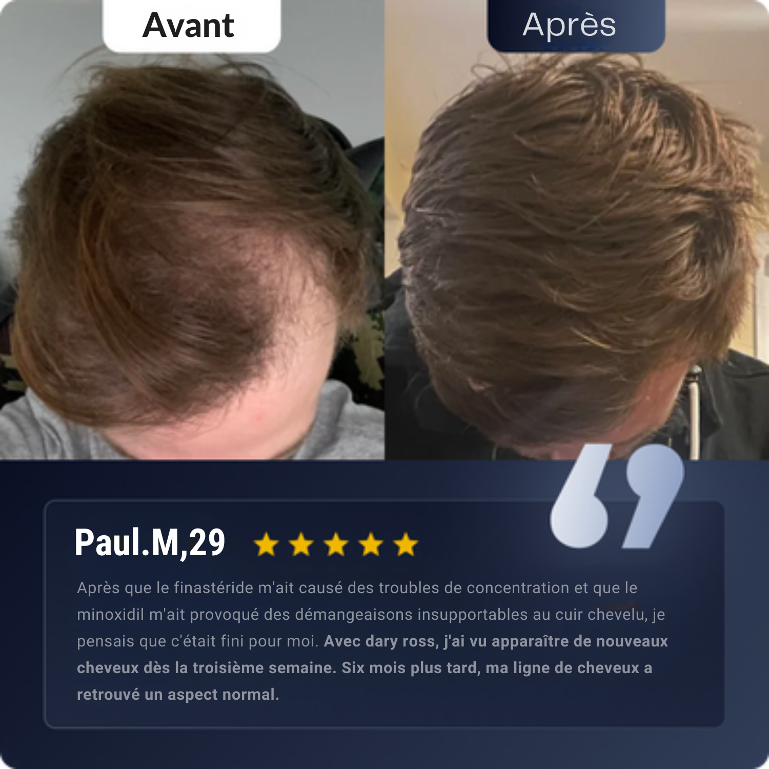 Dary Ross®Sérum de croissance et anti-chute Barbe & Cuir chevelu